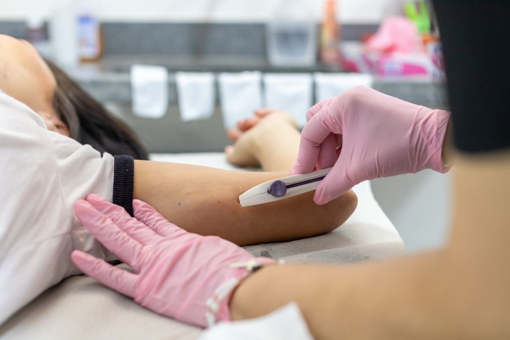 Saiba como funciona a inserção do implante contraceptivo nas USFs de Cuiabá